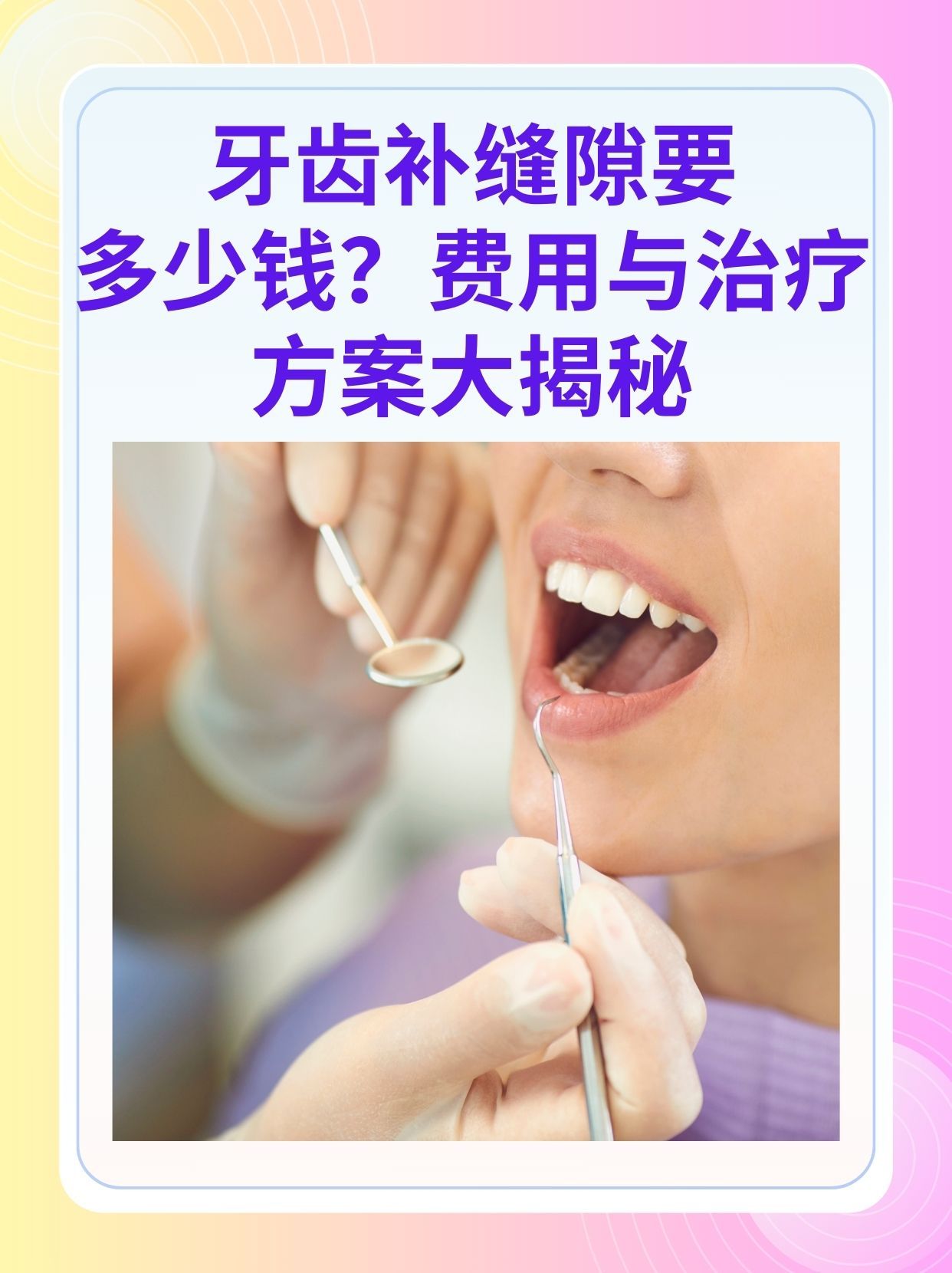 衡阳补牙医保可以报销吗(补牙医保可以报销吗 哪些可以报销呢)